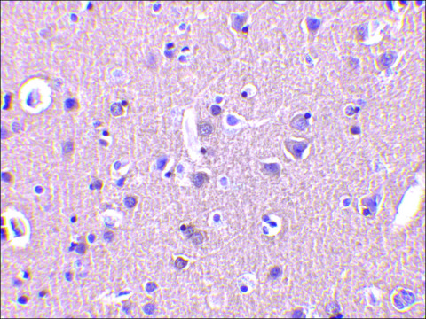 Anti-CRMP1 antibody produced in rabbit