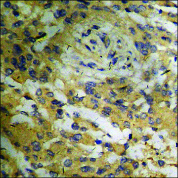 Anti-phospho-Bloom Syndrome (pThr??) antibody produced