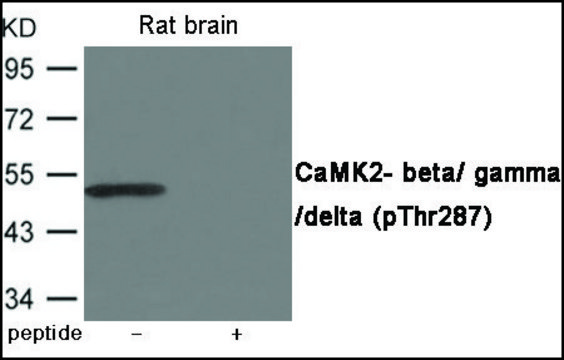 Anti-phospho-CaMK2-?/?/? (pThr²??) antibody produced in