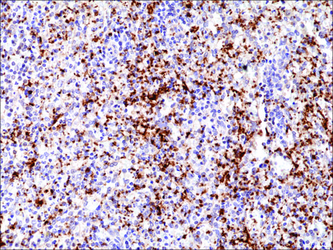 Anti-Integrin beta3/CD61 antibody, Rabbit monoclonal