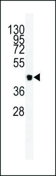 ANTI-VEGFC antibody produced in mouse