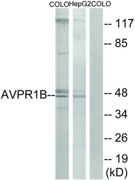 Anti-AVPR1B antibody produced in rabbit