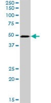 Anti-PSMD6 antibody produced in rabbit