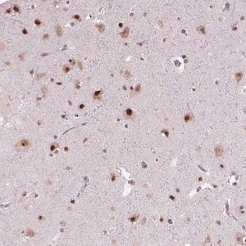 Anti-DDX41 antibody produced in rabbit