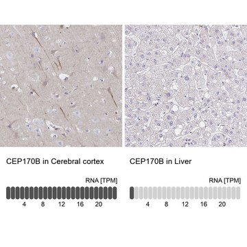 Anti-CEP170B antibody produced in rabbit