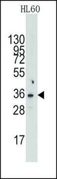 Anti-NUDT6 (C-term) antibody produced in