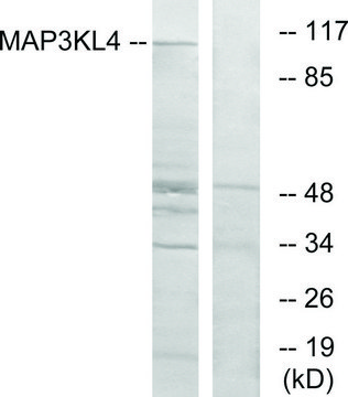 Anti-MAP3KL4 antibody produced in rabbit