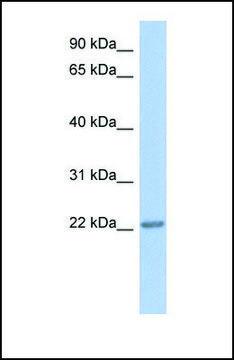 Anti-TRAPPC5 antibody produced in rabbit