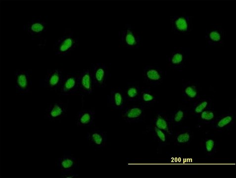 ANTI-ZHX1 antibody produced in mouse