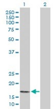 Anti-PPP3R2 antibody produced in rabbit