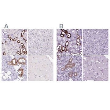 Anti-BSND antibody produced in rabbit