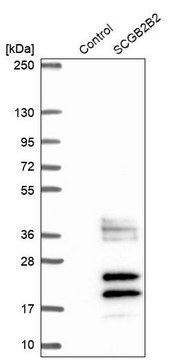 Anti-SCGB2B2 antibody produced in rabbit