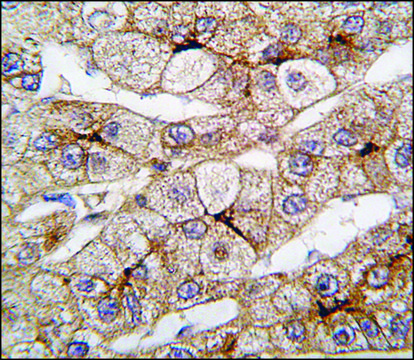Anti-CYP4F12 (N-term) antibody produced in