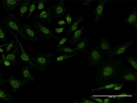 Monoclonal Anti-FBXL19 antibody produced in
