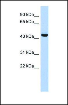 Anti-EXOC4, (N-terminal) antibody produced in