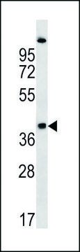 ANTI-RQCD1 (CENTER) antibody produced in
