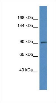 Anti-ADAMTS6 antibody produced in rabbit