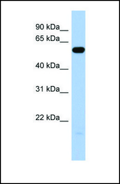 Anti-ILDR1 antibody produced in rabbit