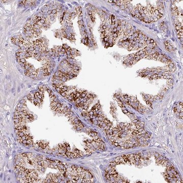 Anti-ATP6V1E2 antibody produced in rabbit