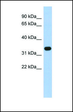 Anti-SULT1B1, (N-terminal) antibody produced in