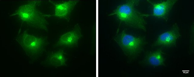 Monoclonal Anti-BICD2 antibody produced in
