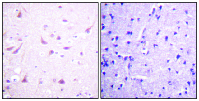 Anti-DRP-2 antibody produced in rabbit