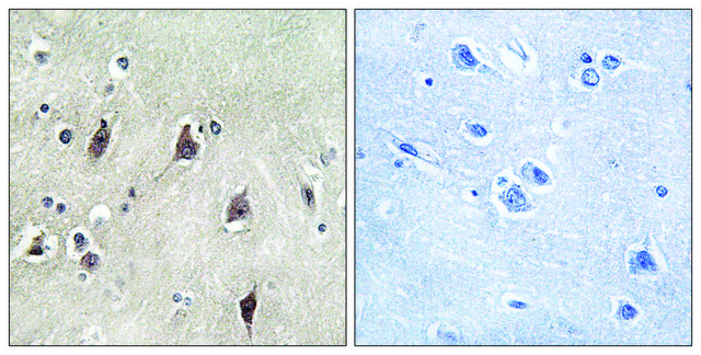 Anti-p70 S6 Kinase antibody produced