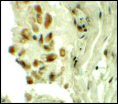 Anti-TYW1 antibody produced in rabbit