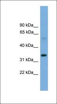 Anti-TM7SF4 antibody produced in rabbit