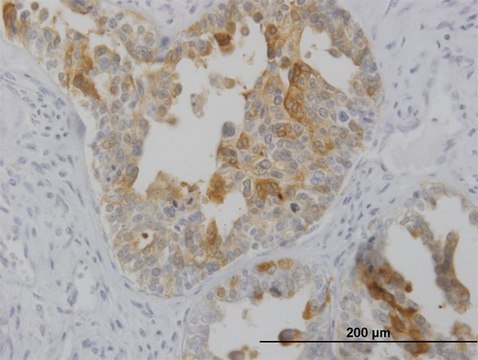 Monoclonal Anti-LMTK2 antibody produced in