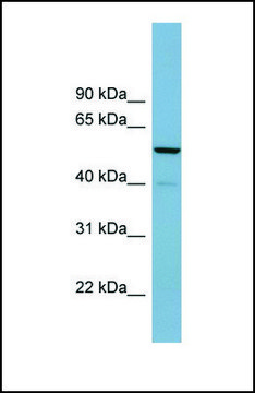 Anti-CDK5RAP1, (N-terminal) antibody produced in