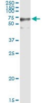 Anti-GFPT2 antibody produced in rabbit