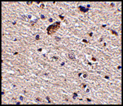 Anti-Spred1 (ab2) antibody produced in