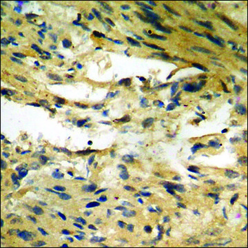 Anti-phospho-Merlin (pSer¹?) antibody produced in
