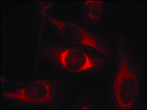 Anti-phospho-TP53 (pSer??) antibody produced in