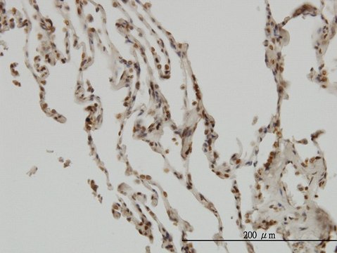 ANTI-NFKBIB antibody produced in mouse