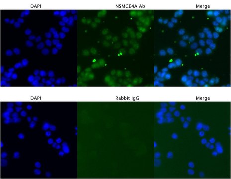 Anti-NSMCE4A (C-terminal) antibody produced in