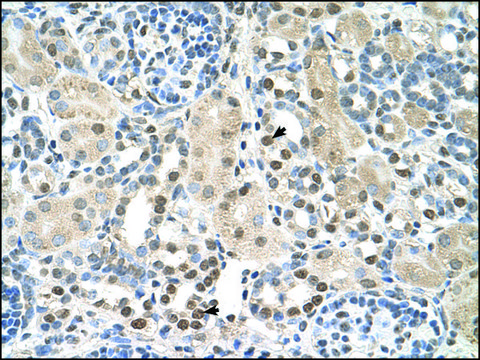 Anti-PSAT1 antibody produced in rabbit