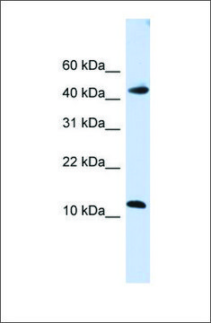 Anti-APOBEC3F antibody produced in rabbit