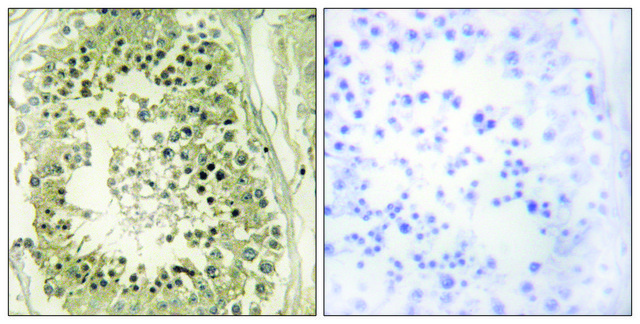 Anti-HGS antibody produced in rabbit
