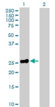 Anti-EPO antibody produced in rabbit