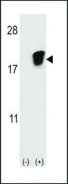 ANTI-SNRPD1 (CENTER) antibody produced in
