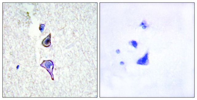 Anti-MRC2 antibody produced in rabbit