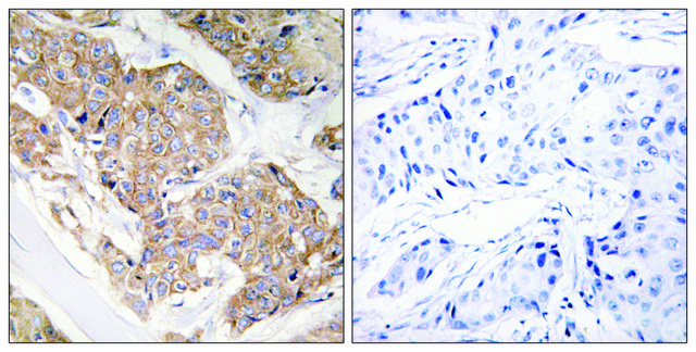 Anti-IL-13R antibody produced in rabbit