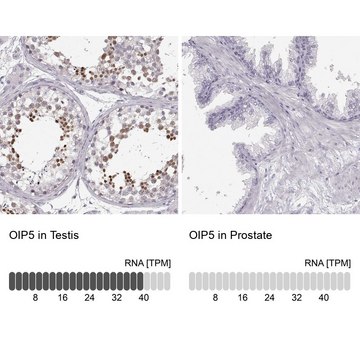 Anti-OIP5 antibody produced in rabbit