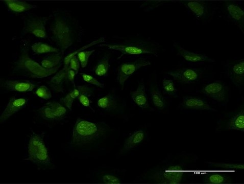 Anti-BAG1 antibody produced in rabbit