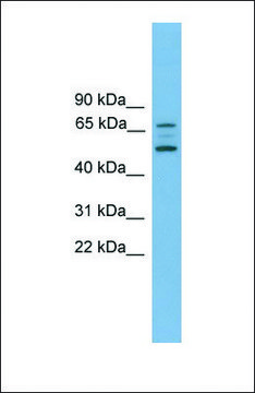 Anti-ACVR2B antibody produced in rabbit