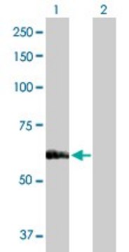 Anti-SARS antibody produced in rabbit