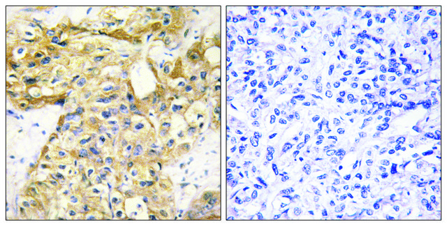 Anti-Collagen XVIII ?1 antibody produced