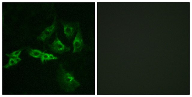 Anti-GNRHR antibody produced in rabbit